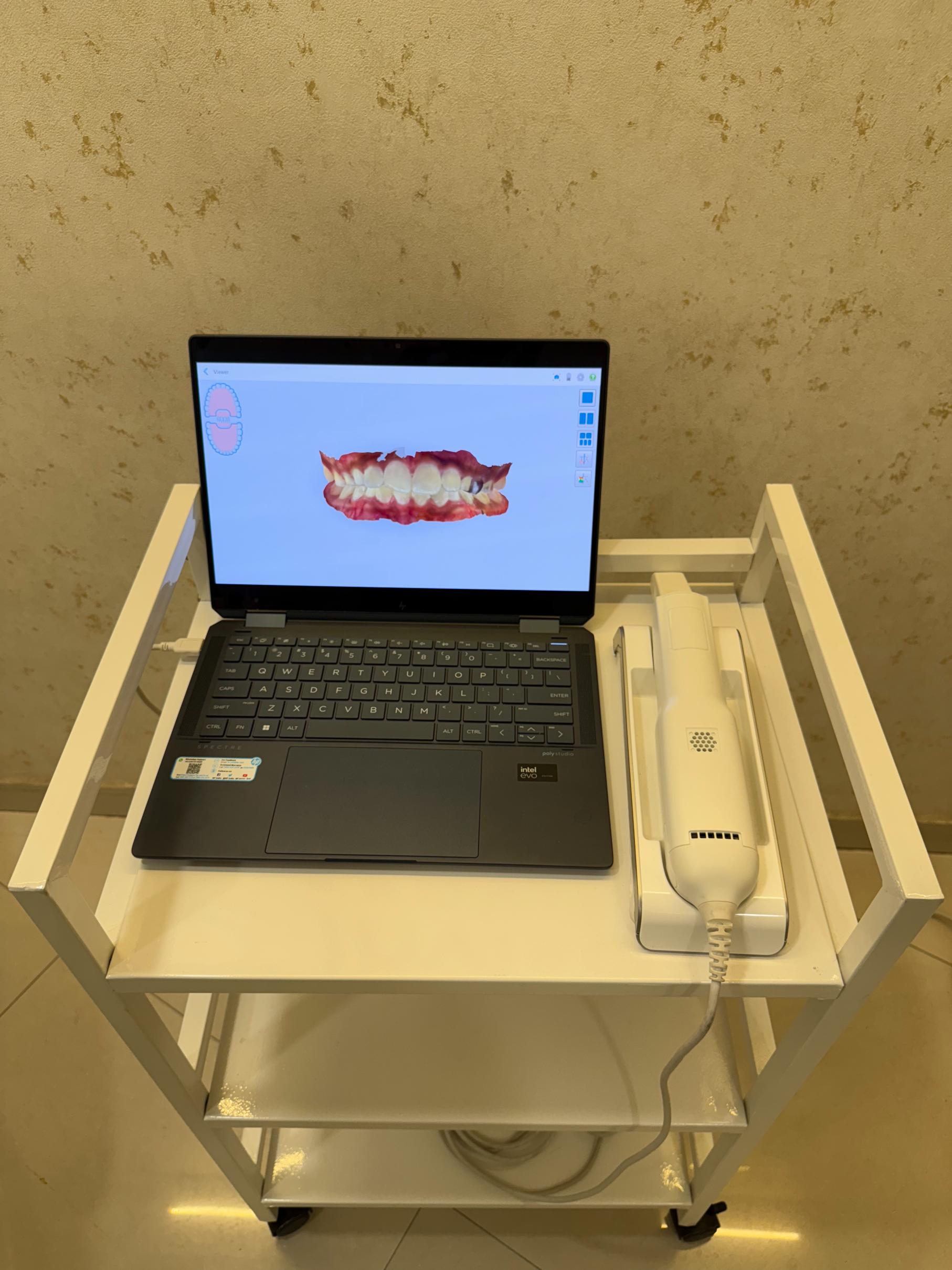 itero scanner baner itero scanner baner