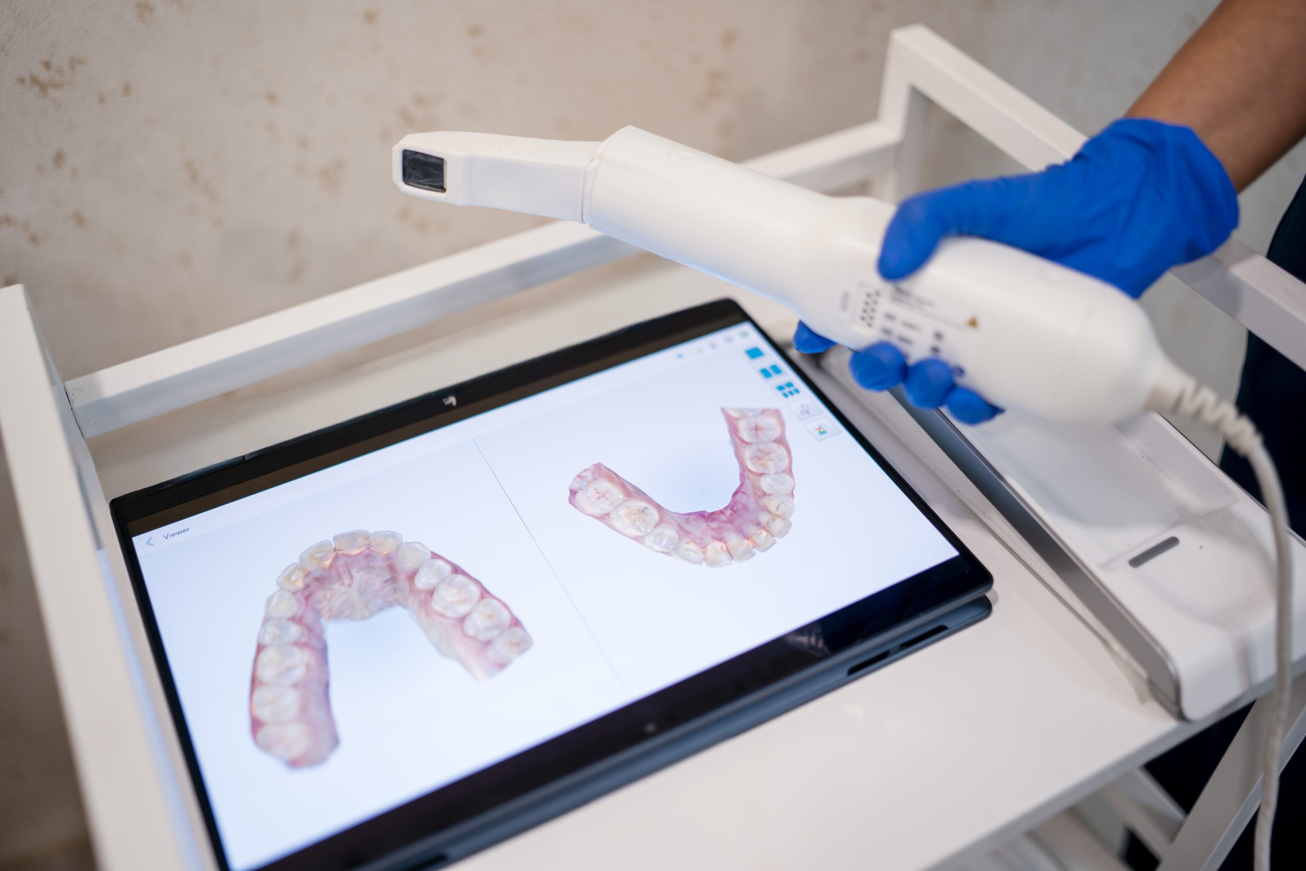 Itero scanner at house of tooth baner Itero scanner at house of tooth baner