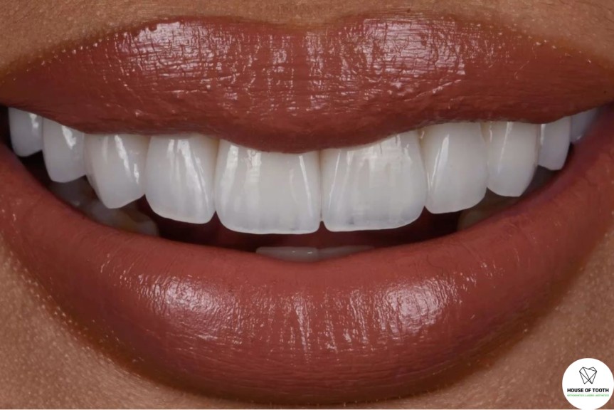 smile designing pune