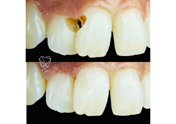 cosmetic dentist near me