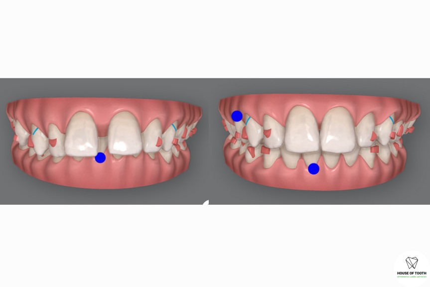 digital dentistry